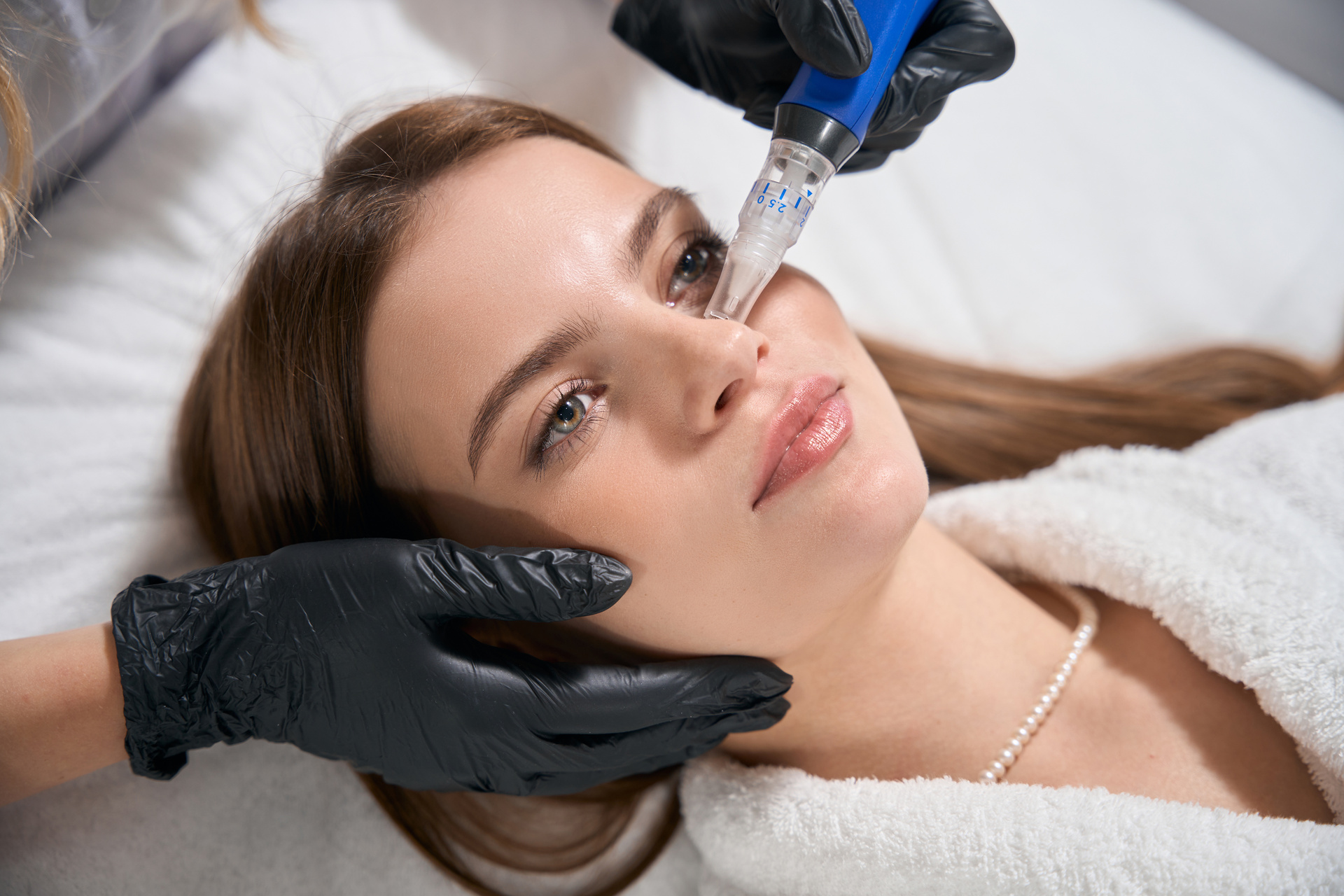 Zabieg Mezoterapia mikroigłowa – Skin Pen